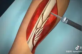 骨头可以在生长👍视频封面