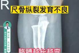 发现孩子胳膊越来越弯，很可能是罕见的 #上肢纵列缺失，通过手术可以矫正前臂力线，恢复功能及外观。视频封面