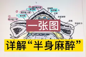 “半身麻醉”还可以分好几种？一张图详细告诉你！视频封面
