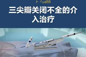 #医学科普 #微创手术 #3d动画演示 #三尖瓣关闭不全@宁夏回族自治区人民医院心脏大血管外科视频封面