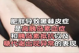 #黑棘皮病 毁了多少爱美的人，脖子黑怎么洗也洗不干净，原因出在xue糖上！#糖尿病#减肥 #减重代谢手术