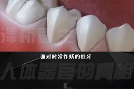 牙虫是什么？你的牙齿有虫吗？#口腔健康 #爱护牙齿 #牙齿健康 #科普 视频封面