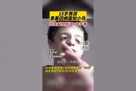 #男孩患鸟面综合征 #特雷彻柯林斯综合征 #遗传病筛查 #鸟面综合症 #孩子成长视频封面