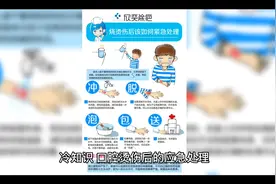 口腔烫伤预防和治疗