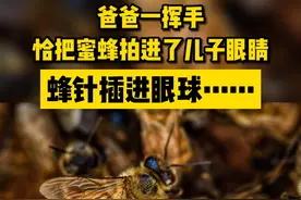 哭不出来！爸爸一挥手竟把蜜蜂拍进了10岁儿子眼睛里，蜂针插入眼球……#东莞 #广东dou知道 视频封面