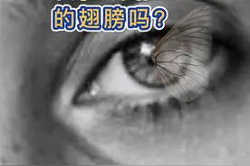 你见过长在眼睛里的小翅膀吗？#保护视力 #护眼爱眼 #翼状胬肉手术 #近视防控  视频封面