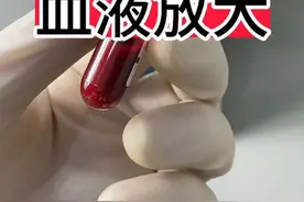 #血液 #显微镜下的世界 #微观世界 #熬夜 #科普 @抖音短视频视频封面