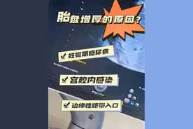 #黄帅医生 #胎盘增厚#胎盘 #边缘性脐带入口 血糖高、宫内感染、脐带插入点靠边通常引起胎盘增厚。#妊娠期糖尿病视频封面