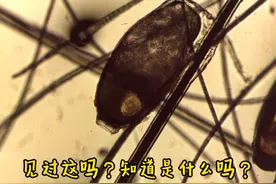 为什么经验越丰富的医生胆子越小，说话越谨慎？yl上没有绝对的视频封面