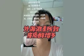 外用激素所致皮质醇增多带来血压高、糖尿病、高脂血症，促肾上腺皮质激素和皮质醇减退，而且哦，已经刺激垂体生长微腺瘤。#医学科普 #硬核健康科普行动 #高血压 #激素 #医学知识科普