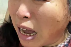 看见这一刻，我心都碎了，不知道妈妈年轻的时候经历了什么呢！当妈的不容易，都为自己的儿女操不完的心，长期积压在心里的东西太多太多，看着就心痛！现在这样来惩罚自己，唯一的方式，就是自己要想开一点，不要着急。爆发出自己的心声，眼神含有一种害怕，泪水流出了无懒……接下来不知道还会发生……#农村生活 #农村 #妈妈 @农村海波视频封面