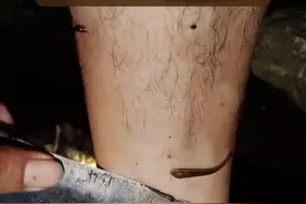 户外趣味知识第15集 对付蚂蟥妙招 蚂蟥简直是山里人的噩梦啊！小时候在田里就被蚂蟥叮过#农村生活 #真实户外 #生活常识 #生存技能