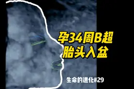 孕34周B超 宝宝快速增重 绒毛胎脂消退 #孕期知识 #胎儿发育视频封面