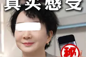拉皮手术恢复期长吗？ 听听求美者的真实反馈#拉皮 #拉皮手术 #面部年轻化 #整形外科刘天一主任视频封面