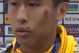 戴伟浚脸上被黎巴嫩球员踢伤了 国足队员尽力了 唯独缺个进球#国足 #戴伟浚视频封面