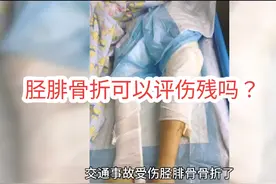 交通事故受伤胫腓骨骨折了，保险公司却说不构成伤残，有理吗?视频封面