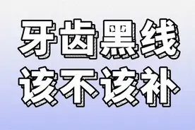 牙齿黑线该不该补#牙齿龋坏#牙齿黑线