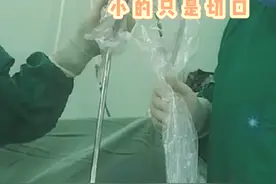 #医学科普 腹腔镜手术是微创手术，就通过几个小孔进行腹腔内的操作，所以又被称为钥匙孔手术，视频展示的就是一个操作孔（腹腔镜镜头孔） #科普一下#医学生 #医生 #医者仁心视频封面