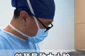 斜颈导致大小脸症状，说明患者面部骨头已经发生改变 #斜颈 #肌性斜颈 #面诊视频封面