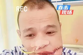 #槟榔 你不要以为你吃了几年没事，等真正有问题就这样了，不做后悔的榔人，早戒早解脱#槟榔的危害 #湖南