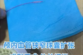 颅内血管狭窄的介入手术是怎么做的？压力泵下球囊扩张成形术，必要时再植入支架。体外教学模拟训练。#动脉粥样硬化 #狭窄 #球囊 #支架 #珠江医院脑血管病专科刘彦超医生 @抖音 @抖音短视频视频封面