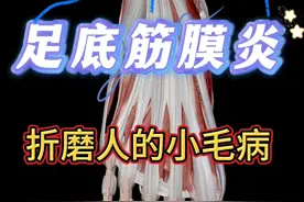 足底筋膜炎是怎么回事？ #足底筋膜炎 #足跟痛 #脚后跟痛 #硬核科普健康行动 #抖出健康知识宝藏