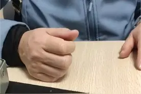 52岁女患者，闽侯人，反复右手触电样麻木2个月 #上热门 #神经外科 #手麻 #腕管综合征 #微创手术视频封面