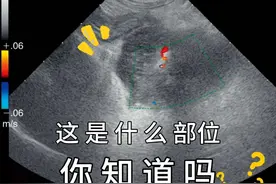 诊断急性胰腺炎思路 #超声影像 #宠物医院的那些事  #兽医视频封面