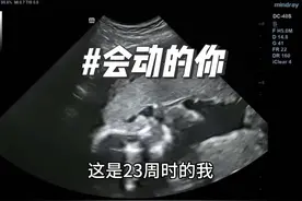 B超下的宝#胎宝宝在肚子里的状态视频封面