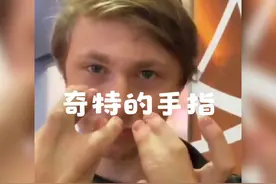 拥有奇怪手指的小伙