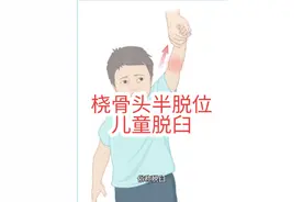 桡骨头半脱位，儿童脱臼#医生日常 #工作日常 #小孩的胳膊脱臼了怎么办 #桡骨头半脱位 #脱臼视频封面