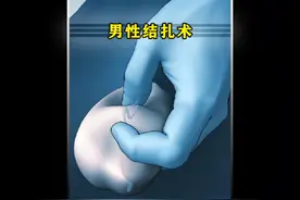 一分钟带你了解结扎全过程。#知识科普 #科普一下 #知识分享视频封面