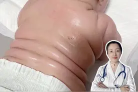 儿童肥胖真的存在！家长们一定要注意 #儿童肥胖 #儿童过于肥胖有什么危害 #小孩肥胖怎么治疗 #育儿经验分享 #科普一下