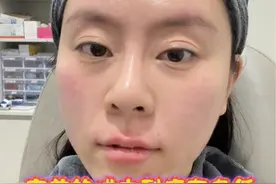 韩国do脸vlog 微do10%#韩蠕蠕 #韩国do脸 #do脸视频封面