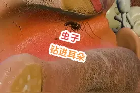 蚊子钻进耳朵，虫子为什么喜欢钻耳朵？#耳朵#涨知识视频封面