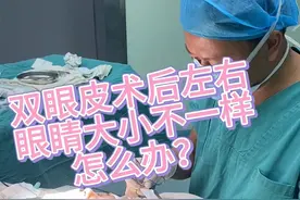 #医学知识科普 #双眼皮 关于双眼皮早期恢复过程中不对称常见原因。视频封面