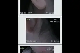 #耳垂有痣 #痣的含义 #痣的魅力 左右双耳垂都有痣视频封面