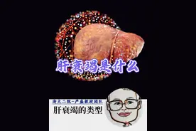 肝脏衰竭是什么 #硬核健康科普行动 #医疗创作者培优计划 #肝胆胰外科严盛视频封面