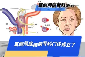 10月开始，周一下午解放路院区开设耳侧颅底疾病专科门诊，这是浙江省内第一个，也是国内首个以神经外科为主导的耳侧颅底专科门诊，专注于面、听、后组神经为中心的各种耳侧颅底肿瘤和功能性疾病的手术治疗：1.听神经瘤、面神经鞘瘤个性化手术治疗；2.面肌痉挛、三叉神经痛等微创手术治疗；3.重度面瘫综合手术治疗；4.眩晕综合症手术干预；5.颈静脉孔区和岩斜区病变，如神经鞘瘤、颈静脉球瘤、脑膜瘤、骨软骨瘤、脊索瘤等的手术治疗。 有需要的病友可以预约门诊咨询。 #浙大二院 #浙二医院 #神经外科 #侧颅底 #医学科普视频封面