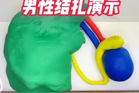 揭秘男性结扎手术全过程，“实体”演示！男人必看！#上热门视频封面