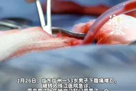 广东53岁大叔将20厘米节瓜塞入肛门结果取不出来 腹痛难忍无奈就医 医生花费三小时才为其取出 医生发现男子肛门比较松弛 可能是经常塞异物视频封面