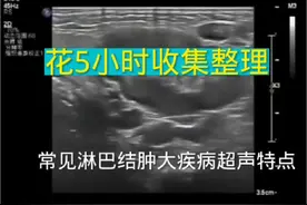 常见淋巴结肿大疾病超声特点 常见淋巴结肿大疾病超声特点。#医学科普 #超声影像 #淋巴结肿大 #医学小知识 #超声医学 @抖音短视频