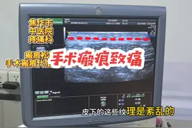 手术后瘢痕粘连是引起身体疼痛的原因之一 #瘢痕#疤痕增生