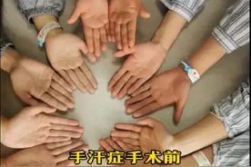 #dou来说健康 #肋骨被撞后呼吸和用力就疼怎么办  #手汗 #手汗症 #手汗症患者视频封面