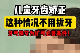 ⚠️注意，儿童嘴凸下巴后缩牙齿矫正这种情况无需拔牙！ #牙齿矫正 #下巴后缩 #儿童牙齿矫正 #正畸 #拔牙矫正