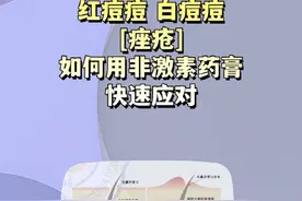 痤疮，炎症性丘疹、粉刺，教您用两种非激素药膏快速应对#痤疮痘痘 #粉刺 #抖出健康知识宝藏 #解锁春日健康清单 #在抖音pick你的健康搭子