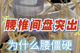 腰部僵硬的原因？为什么腰椎间盘突出会感觉腰僵硬？ #腰椎间盘突出 #腰部不适 #硬核科普说健康 #抖出健康知识宝藏 #抖音创作季