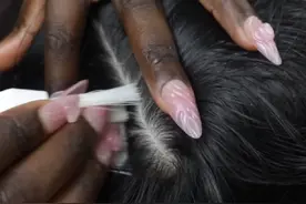 黑白夫妇沉浸式超清头皮油脂粒清洁#油脂粒 #头皮屑 #解压助眠