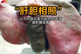 肝脏与胆囊的位置关系 #生命科学 #人体结构 #医学科普仅供参考