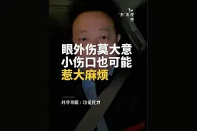 结束一天的门诊，让我印象深的就是有很多外地的#眼外伤 患者，在这里我想呼吁大家，我们的#眼睛 是非常脆弱的，有些眼外伤是不可逆的，我们一定要注意爱护眼睛！#医生日常